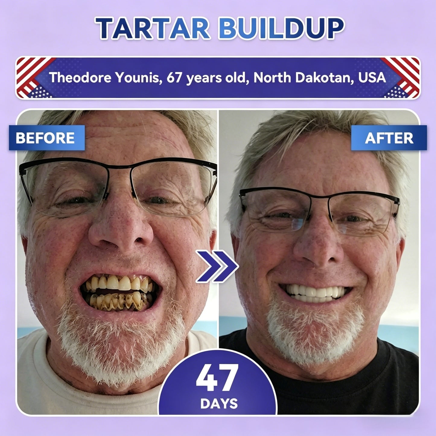 Transform Your Smile Within 30 Minutes Or Your Money Back!