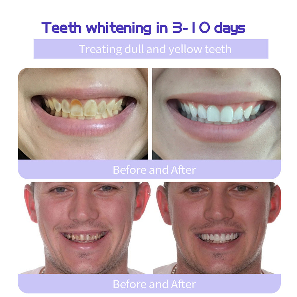 🎁Flash Sale - Don’t Miss Out - KLENIMORE TeethRestoration Mineral Powder🦷(TGA recommended)👩‍⚕️(Treats periodontitis and mouth ulcers, prevents tooth loss, and repairs gum recession)