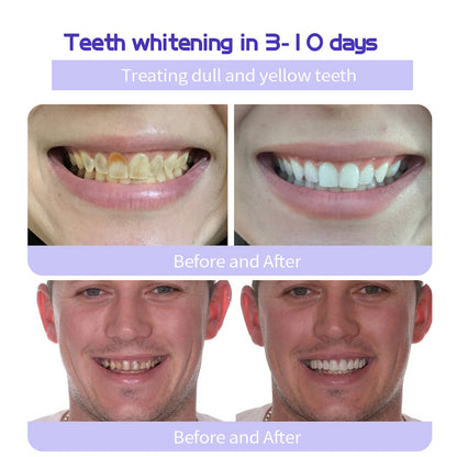 🎁Flash Sale - Don’t Miss Out - KLENIMORE TeethRestoration Mineral Powder🦷(TGA recommended)👩‍⚕️(Treats periodontitis and mouth ulcers, prevents tooth loss, and repairs gum recession)