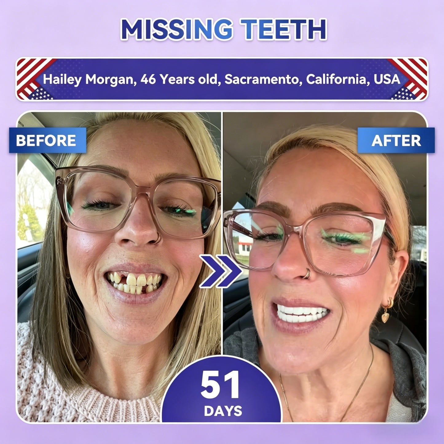 Transform Your Smile Within 30 Minutes Or Your Money Back!