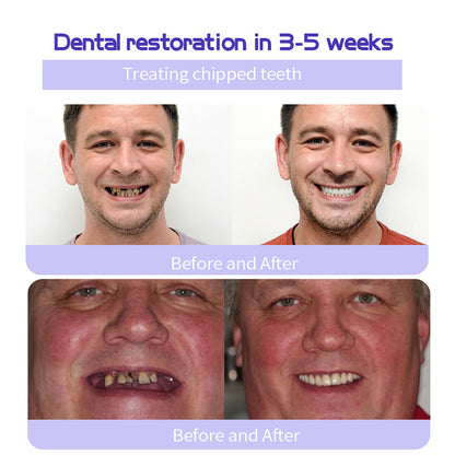 🎁Flash Sale - Don’t Miss Out - KLENIMORE TeethRestoration Mineral Powder🦷(TGA recommended)👩‍⚕️(Treats periodontitis and mouth ulcers, prevents tooth loss, and repairs gum recession)