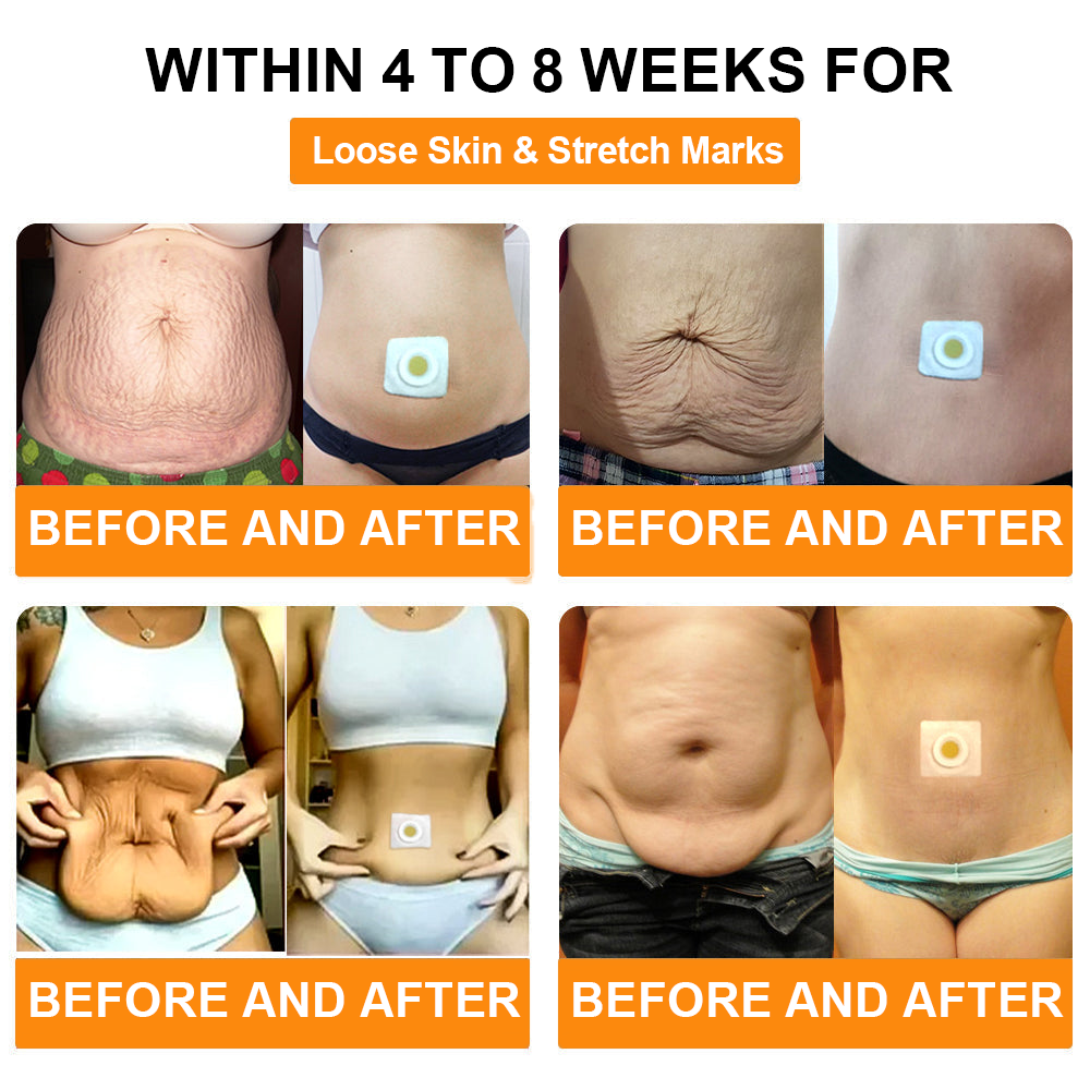 🐝🐝KLENIMORE Bee venom Drainage Slimming Patch🔥