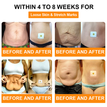 🐝🐝KLENIMORE Bee venom Drainage Slimming Patch🔥