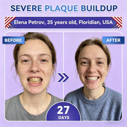 Transform Your Smile Within 30 Minutes Or Your Money Back!