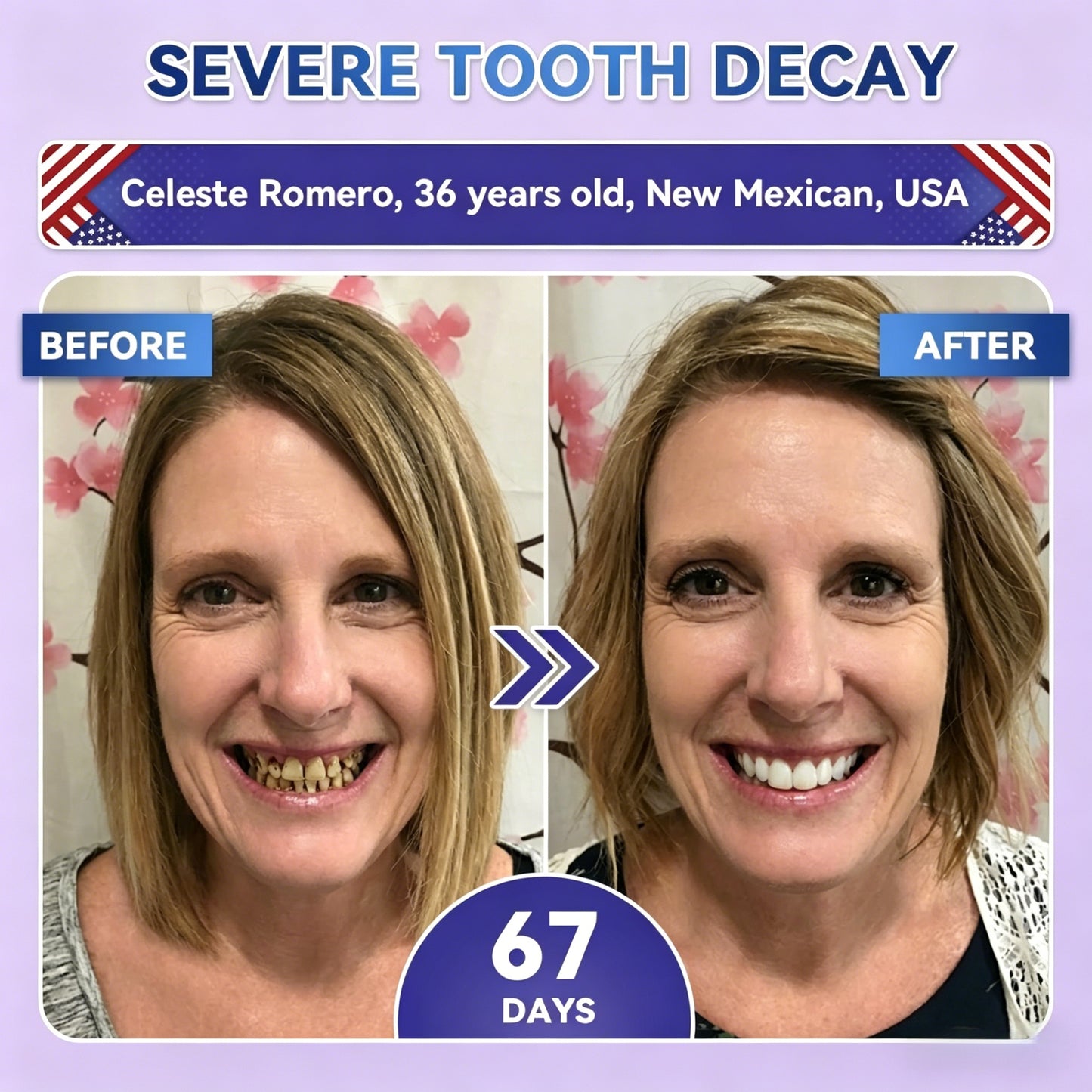Transform Your Smile Within 30 Minutes Or Your Money Back!