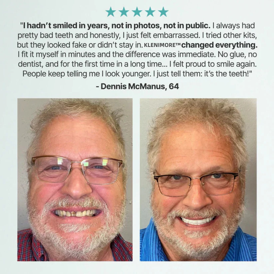 🌎Ends Today: 70% OFF! ⏰ Medical Full Denture with Strong Suctiond