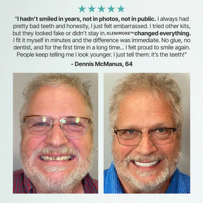 🌎Ends Today: 70% OFF! ⏰ Medical Full Denture with Strong Suctiond