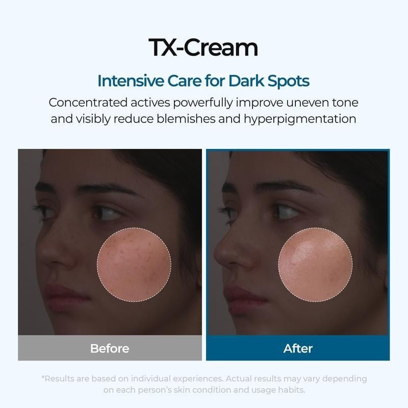 🔥𝙇𝙞𝙢𝙞𝙩𝙚𝙙-𝙏𝙞𝙢𝙚 𝙊𝙛𝙛𝙚𝙧 |Nano-sized Tranexaminc Acid for Dark Spots & Hyperpigmentation