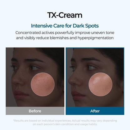 🔥𝙇𝙞𝙢𝙞𝙩𝙚𝙙-𝙏𝙞𝙢𝙚 𝙊𝙛𝙛𝙚𝙧 |Nano-sized Tranexaminc Acid for Dark Spots & Hyperpigmentation