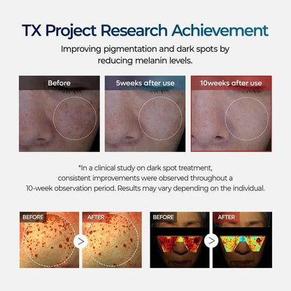 🔥𝙇𝙞𝙢𝙞𝙩𝙚𝙙-𝙏𝙞𝙢𝙚 𝙊𝙛𝙛𝙚𝙧 |Nano-sized Tranexaminc Acid for Dark Spots & Hyperpigmentation